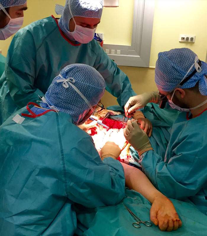 Plexus Brachial Microchirurgie Chirurgie De La Main - 