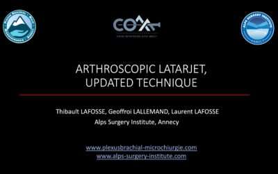 Update dans les Latarjet sous arthroscopie